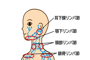 �g�̂̃����p��